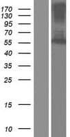 FSCN2 / Retinal Fascin Protein (Over-Expression Lysate Myc-DDK (Flag))