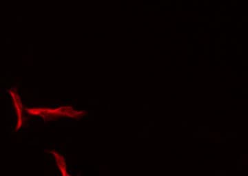 SERPINB12 Antibody