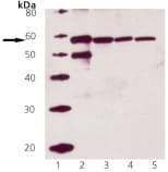 Polyclonal Rabbit anti-Human CALR / Calreticulin Antibody (WB)