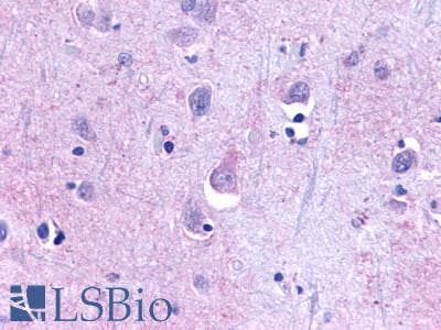 PathPlus™ TAAR9 Antibody (C-Terminus)