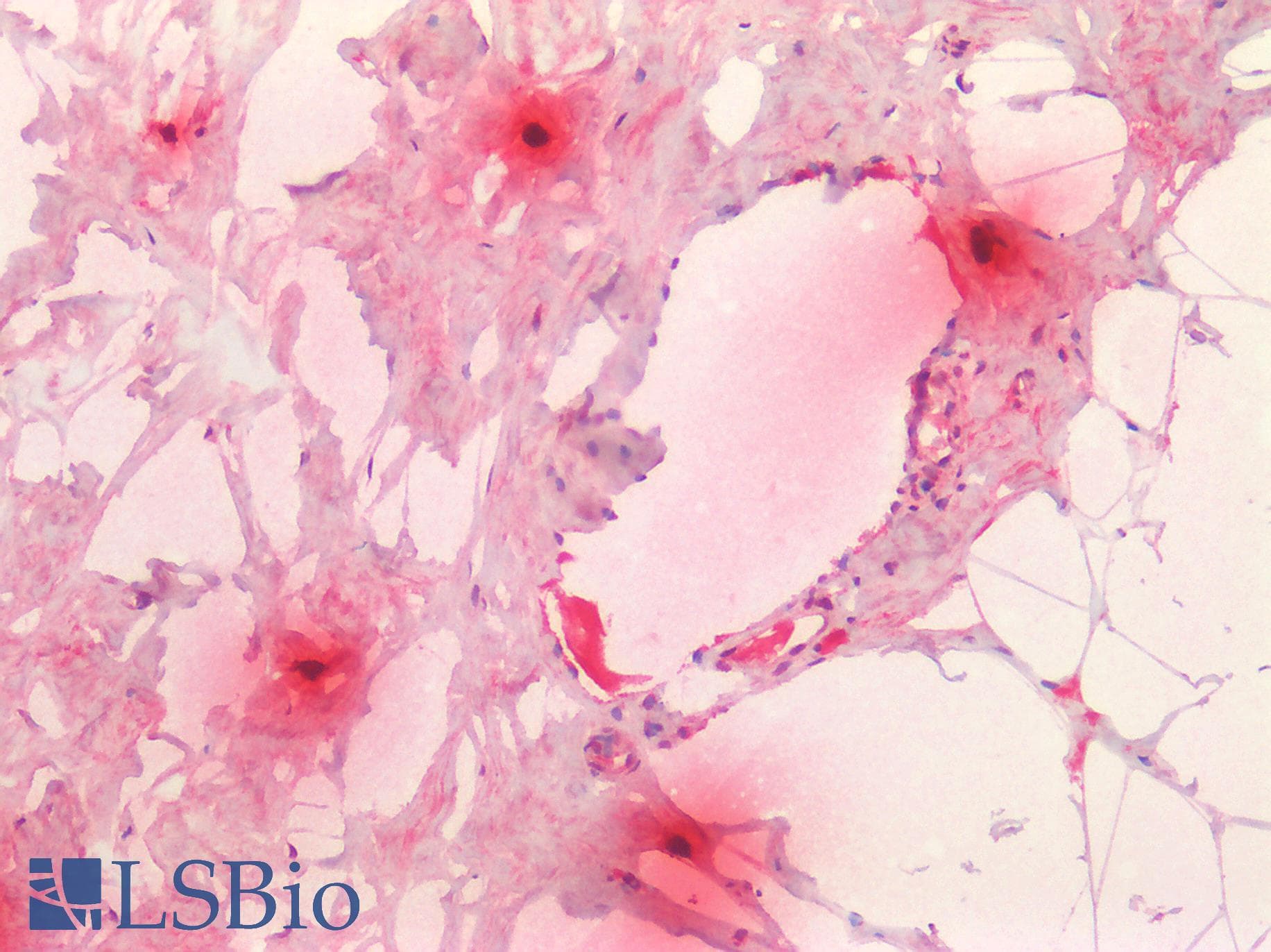 TPSAB1 / Mast Cell Tryptase Antibody (clone C16)