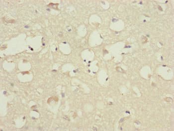 CEP83 / CCDC41 Antibody