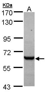 CCT5 / TCP1 Epsilon Antibody (aa1-264)