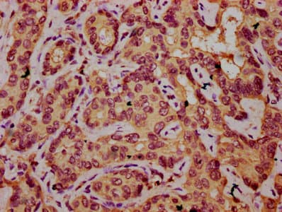 UST Antibody