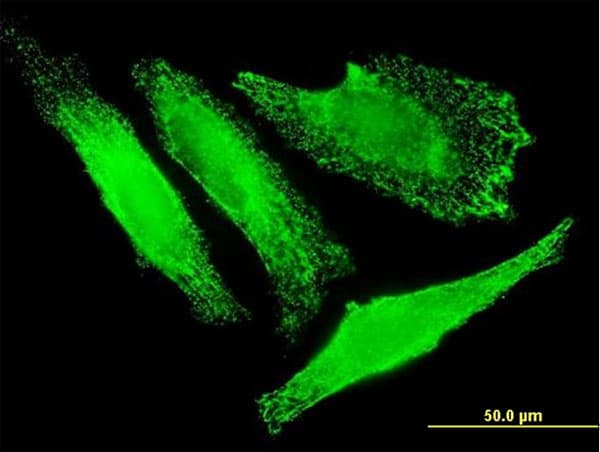 SLC25A20 / CACT Antibody (clone M2)