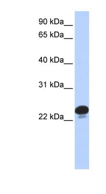 CAPS Antibody (N-Terminus)