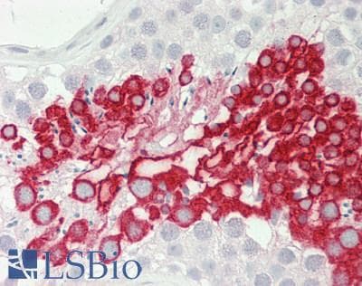 COPS6 / CSN6 Antibody (aa201-250)