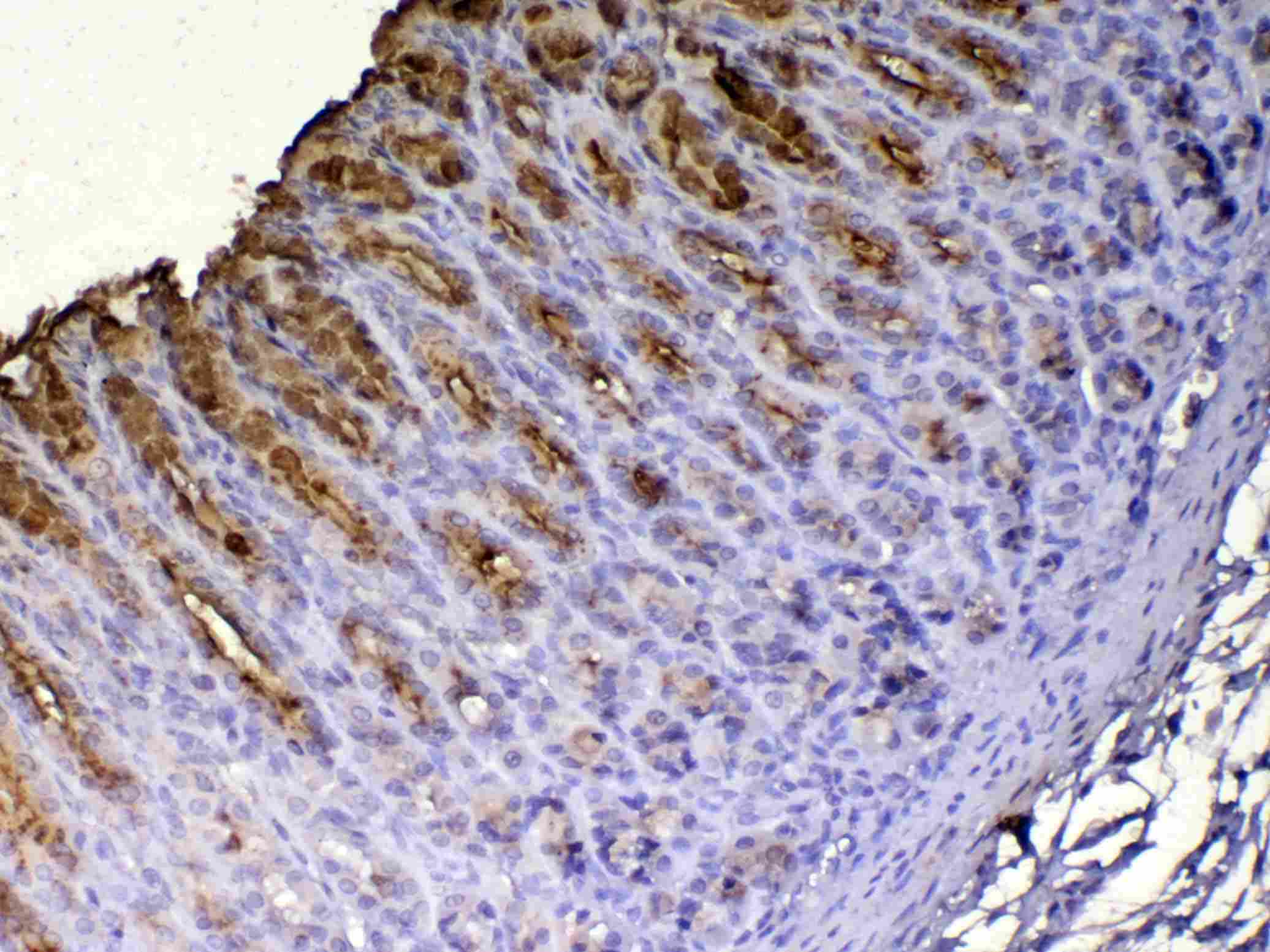 TFF1 / pS2 Antibody
