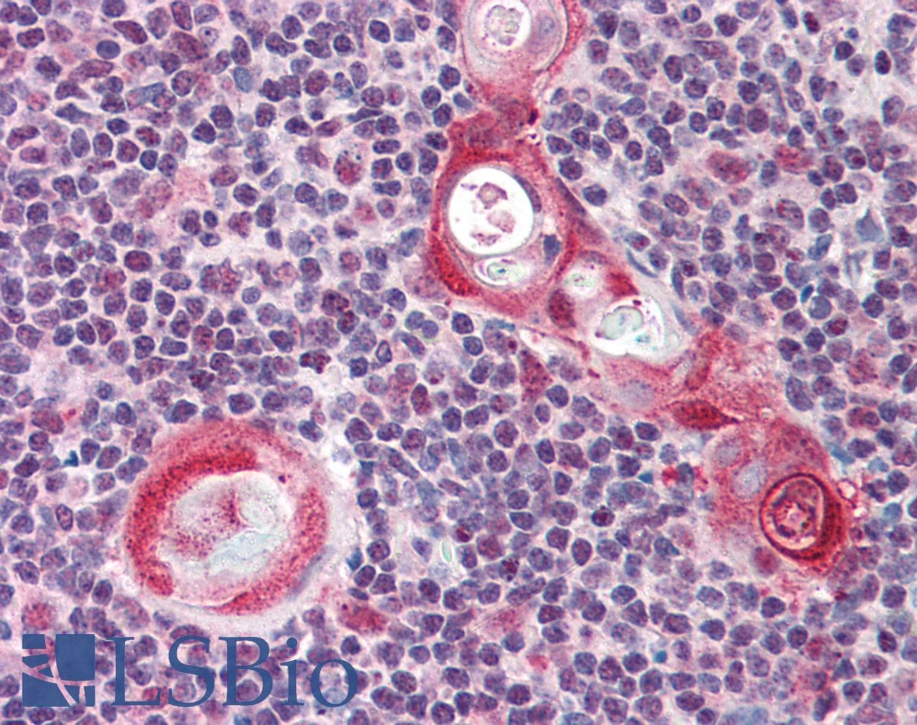 IHC-plus™ FANCG Antibody (aa1-25)