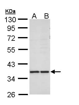IHC-plus™ AKR1B10 Antibody (aa1-316)