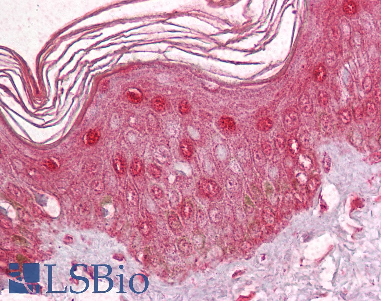 IHC-plus™ ZBTB7A / Pokemon Antibody