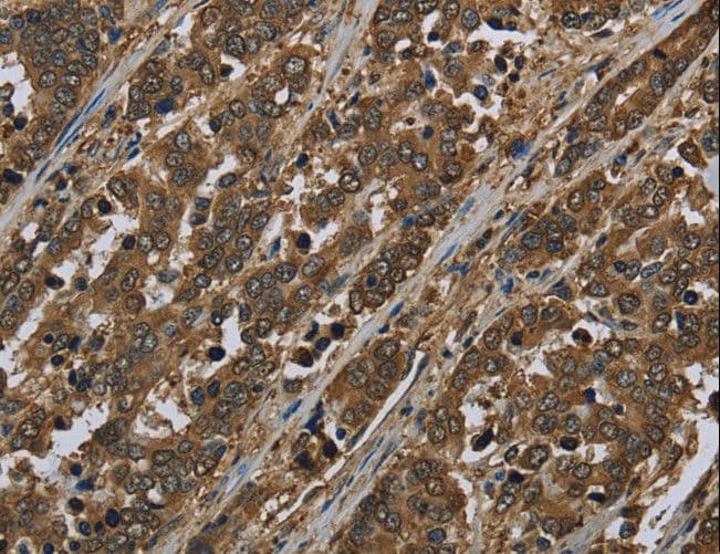 SNCG / Gamma-Synuclein Antibody