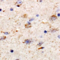 Polyclonal Rabbit anti-Human KCNT1 / KCa4.1 Antibody (IHC, WB)