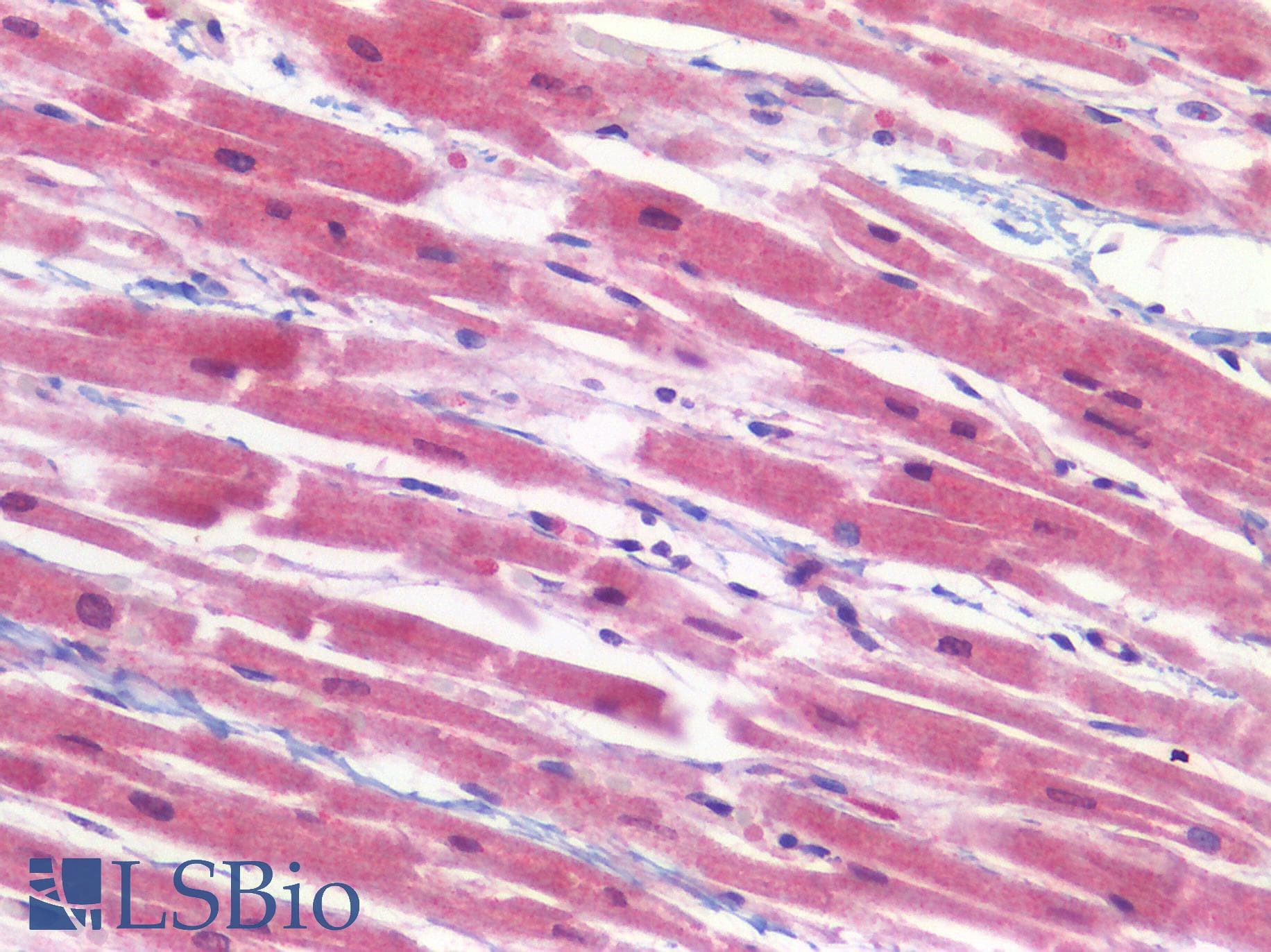 IHC-plus™ FPR1 / FPR Antibody (aa155-204)