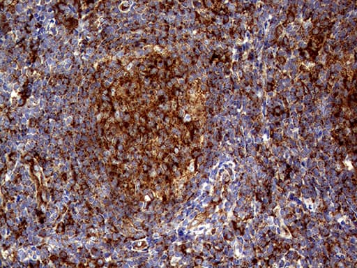 Monoclonal Mouse anti-Human CLTA / LCA Antibody (clone OTI2A6, IHC, WB)