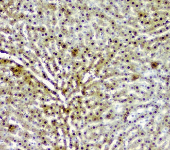 Polyclonal Rabbit anti-Human AKR1D1 Antibody (IHC, WB)