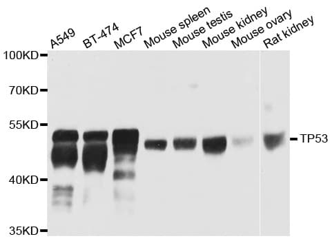 TP53 / p53 Antibody