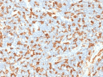 AIF1 / IBA1 Antibody (clone AIF1/1909)