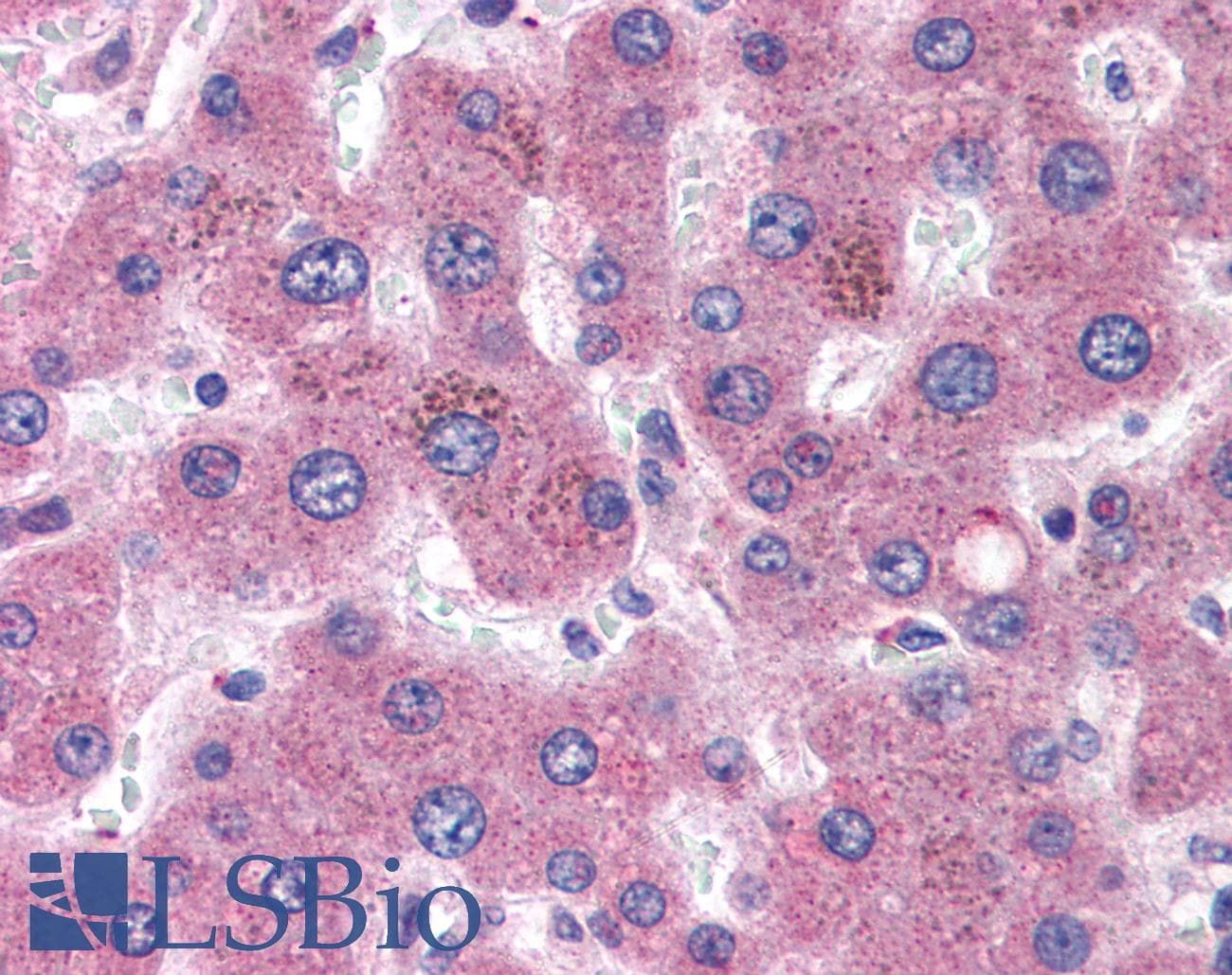 IHC-plus™ Polyclonal Goat anti-Human Apolipoprotein C-I Antibody (aa70-83, IHC)
