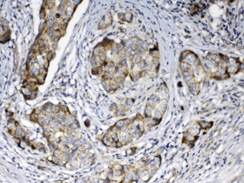 FZD3 / Frizzled 3 Antibody