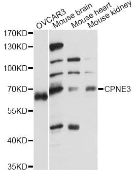 Polyclonal Rabbit anti-Human CPNE3 Antibody (WB)