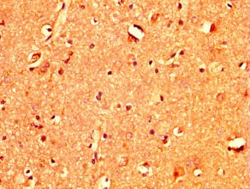 TBX3 Antibody