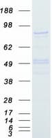 Human SUZ12 Protein (Recombinant Myc-DDK (Flag))
