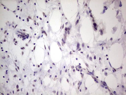 TCF12 / HEB Antibody (aa1-250, clone OTI4D6)