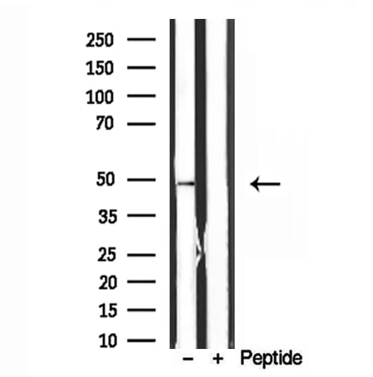 ATP5B / ATP Synthase Beta Antibody