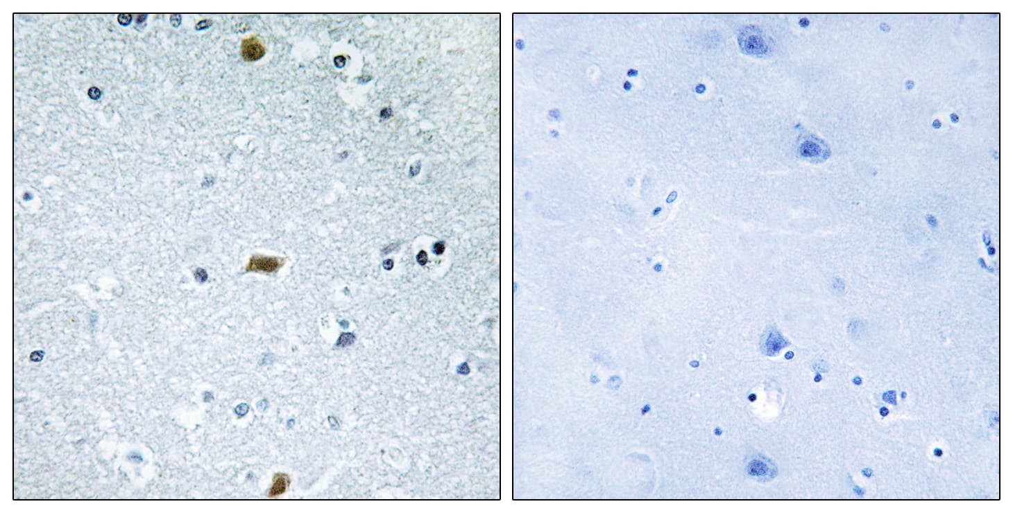 Polyclonal Rabbit anti-Human ZFHX3 / ATBF1 Antibody (aa761-810, IHC)