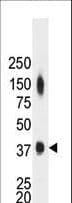 Polyclonal Rabbit anti-Human CKM / Creatine Kinase MM Antibody (aa1-30, WB)