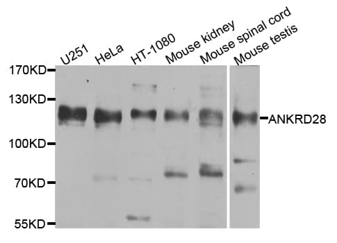 ANKRD28 Antibody