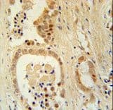 ZNF385B / ZNF533 Antibody (aa1-30)