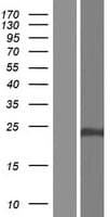 CLDN19 / Claudin 19 Protein (Over-Expression Lysate Myc-DDK (Flag))