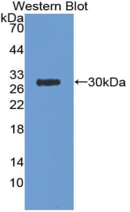 APP / Beta Amyloid Precursor Antibody (aa18-286)