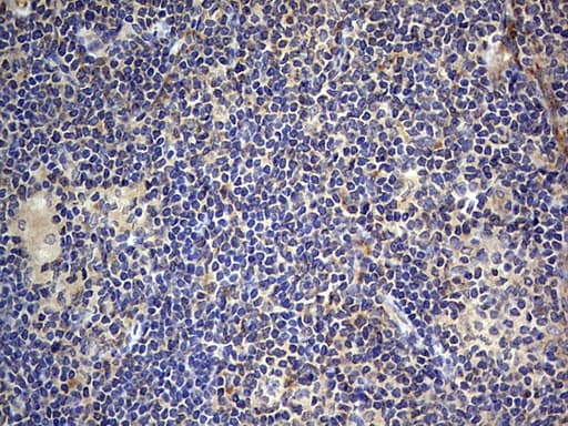 Monoclonal Mouse anti-Human SMPD1 / Acid Sphingomyelinase Antibody (clone OTI3H7, aa62-341, IHC, WB)