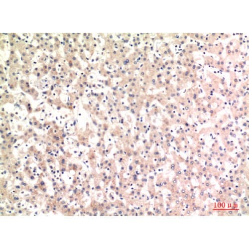 Complement C4a+b Antibody (721-770 aa, Internal)
