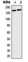 Polyclonal Rabbit anti-Human COL4A5 / Collagen IV Alpha5 Antibody (N-Terminus, IHC, IF, WB)
