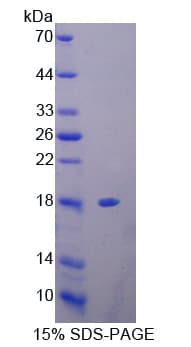 Human PFN3 Protein (Recombinant His-T7)