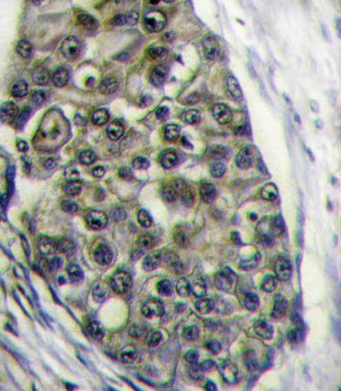 LRP6 Antibody (aa1531-1560)