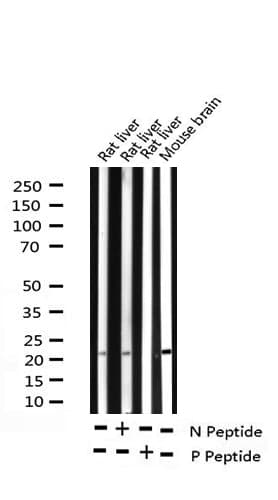 Polyclonal Rabbit anti-Human BAD Antibody (phospho-Ser155, IHC, IF, WB)
