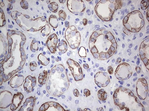 Acidic Cytokeratin Antibody (clone 8A3)