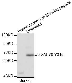 ZAP70 Antibody (phospho-Tyr319)