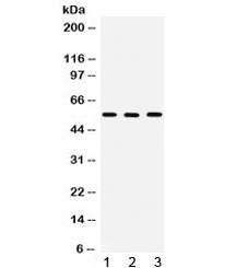 Polyclonal Rabbit anti-Human CCT2 / CCT Beta Antibody (IHC, WB)