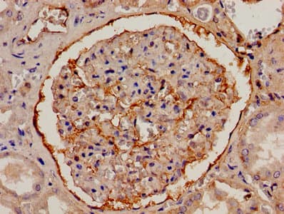 Polyclonal Rabbit anti-Human FGA / Fibrinogen Alpha Antibody (aa36-218, IHC)