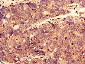 Polyclonal Rabbit anti-Human CTP Synthetase 2 / CTPS2 Antibody