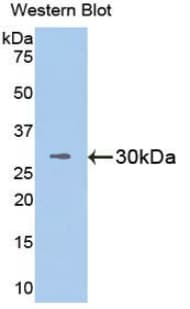 VCAM1 / CD106 Antibody (aa136-372, Cy3)