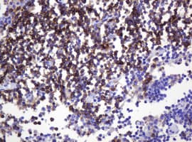 Monoclonal Mouse anti-Human SPN / CD43 Antibody (clone OTI6A4, IHC, WB)