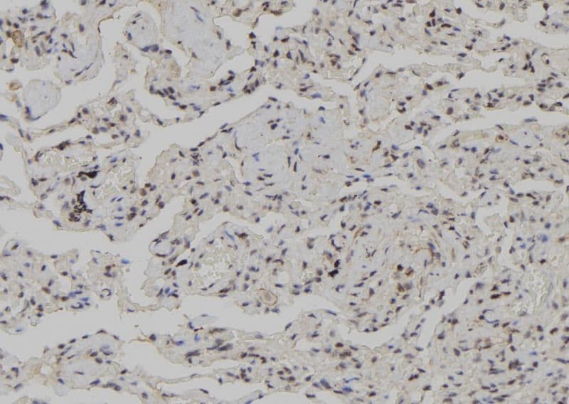 CSNK1G3 / CKI-Gamma 3 Antibody
