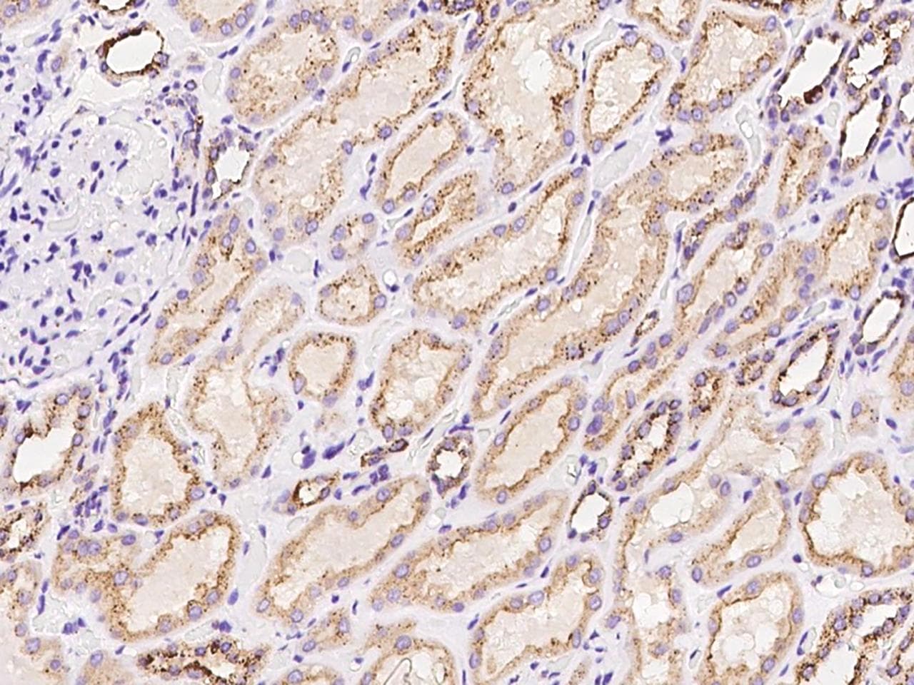 PITPNC1 Antibody